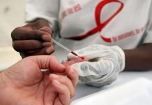 ¿Cuánto tiempo sobrevive el VIH fuera del cuerpo?