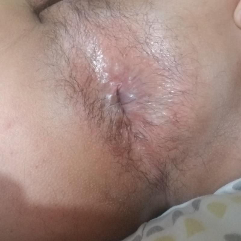 Foto de galería